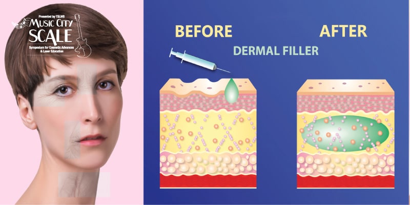 The-Most-Interesting-Uses-for-Dermal-Fillers