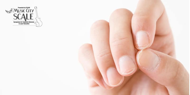 Fingernails-Are-a-Window-Into-Your-Health