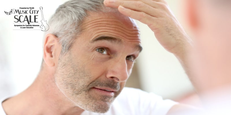 Special-Considerations-for-Bald-Men's-Skin