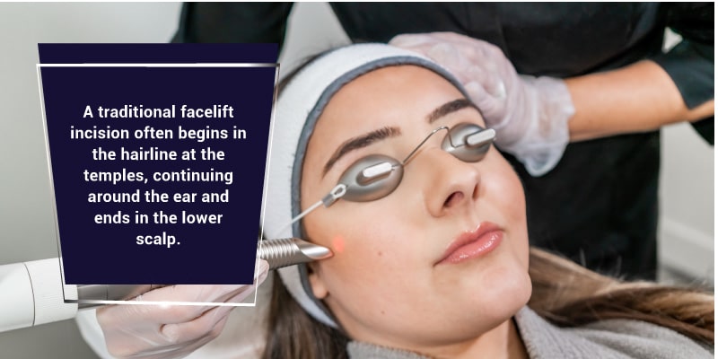 ClearLift-Laser-Treatment-The-LunchTime-Facelift-Without-Surgery-