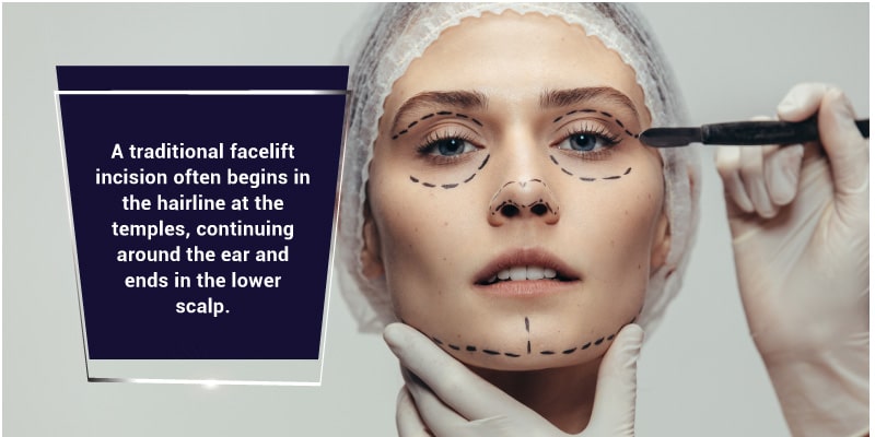 Facelifts-Are-Invasive-and-Costly