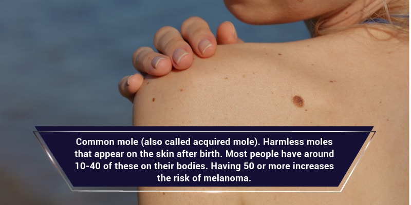 What-Are-Moles